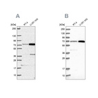 Anti-PES1 Antibody