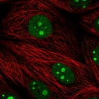 Immunofluorescent staining of human cell line MCF7 shows localization to nucleus & nucleoli.