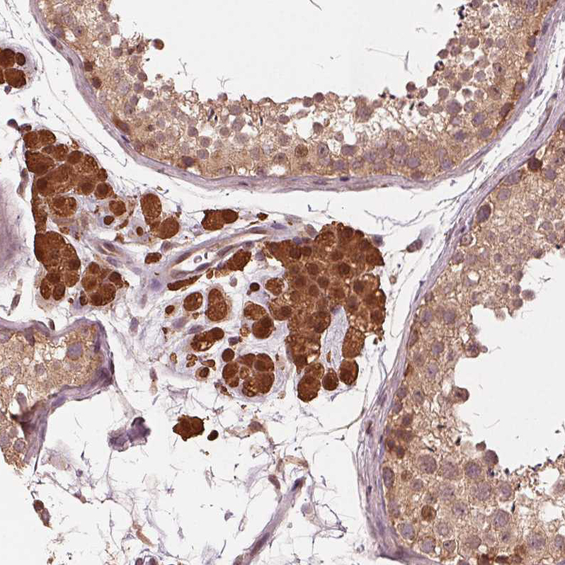 Anti-ZNF471 Antibody
