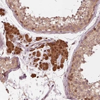 Anti-ZNF471 Antibody