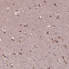 Immunohistochemical staining of human cerebral cortex shows strong nuclear positivity in glial cells.
