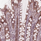 Immunohistochemical staining of human colon shows moderate nuclear and cytoplasmic positivity in glandular cells.