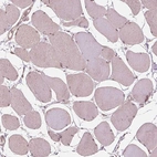 Immunohistochemical staining of human skeletal muscle shows no positivity in myocytes as expected.