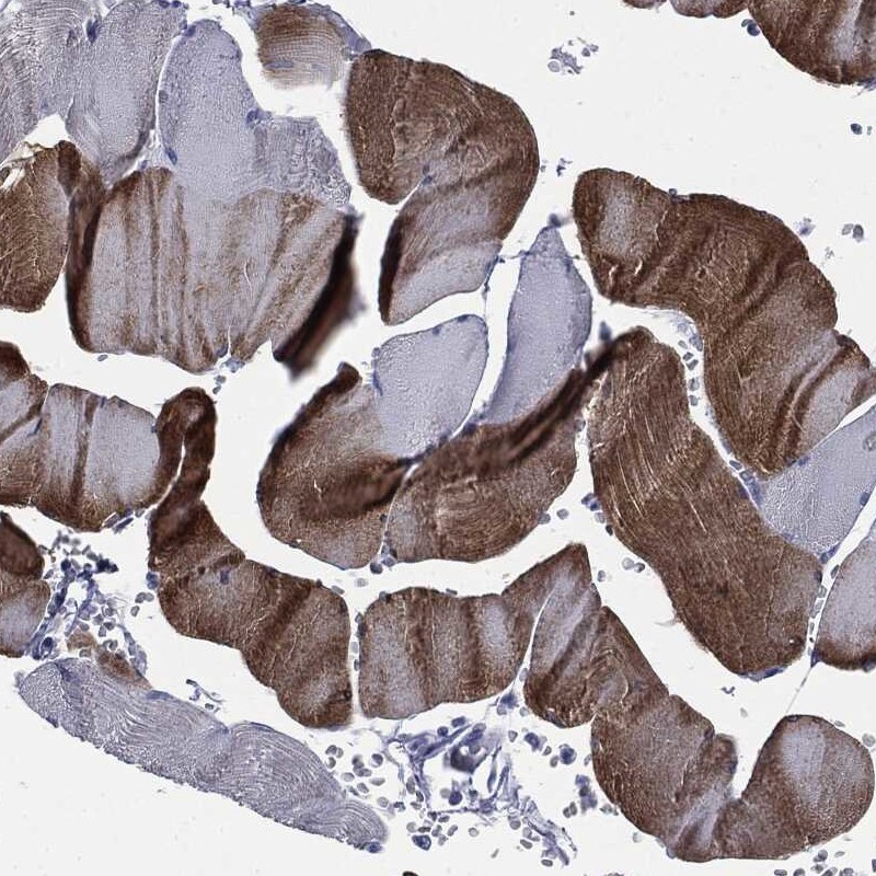 Anti-ATP2A1 Antibody