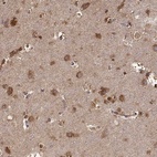 Anti-TARSL2 Antibody