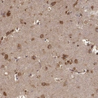 Anti-TARSL2 Antibody