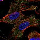 Immunofluorescent staining of human cell line U-2 OS shows localization to cytosol.
