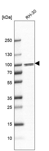 Anti-PARP9 Antibody