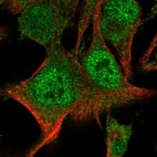 Immunofluorescent staining of human cell line SK-MEL-30 shows localization to nucleoplasm & cytosol.