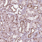 Anti-LSM2 Antibody