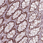 Immunohistochemical staining of human colon shows strong nuclear positivity in glandular cells.
