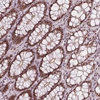 Immunohistochemical staining of human colon shows strong nuclear positivity in glandular cells.