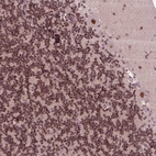 Immunohistochemical staining of human cerebellum shows strong nuclear positivity in Purkinje cells.