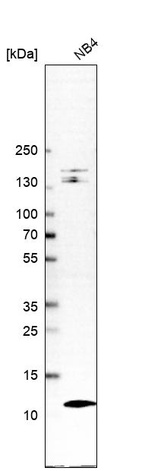 Western blot analysis in human cell line NB4.
