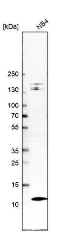 Western blot analysis in human cell line NB4.