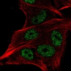 Immunofluorescent staining of human cell line SK-MEL-30 shows localization to nucleus.
