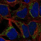 Anti-ANKRD63 Antibody