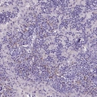 Immunohistochemical staining of human lymph node shows moderate cytoplasmic positivity in lymphoid cells.
