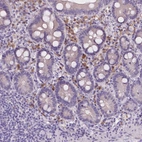 Immunohistochemical staining of human small intestine shows moderate cytoplasmic positivity in lymphoid cells.