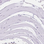 Immunohistochemical staining of human skeletal muscle shows no positivity in myocytes as expected.