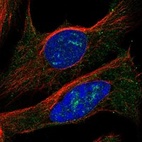 Immunofluorescent staining of human cell line U-2 OS shows localization to nucleoli, endoplasmic reticulum & vesicles.