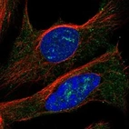 Immunofluorescent staining of human cell line U-2 OS shows localization to nucleoli, endoplasmic reticulum & vesicles.