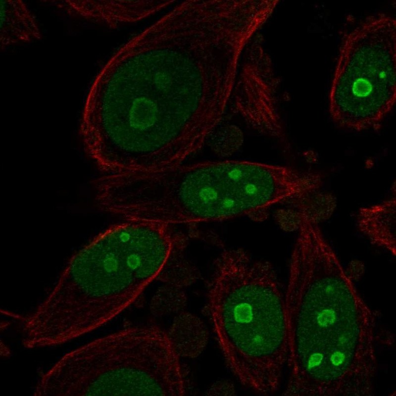 Anti-BOP1 Antibody