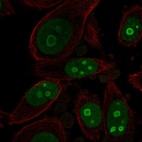 Anti-BOP1 Antibody