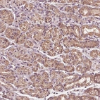 Anti-UBALD1 Antibody