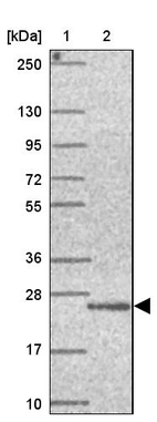 Lane 1: Marker [kDa] 250, 130, 95, 72, 55, 36, 28, 17, 10_br/_Lane 2: Human cell line RT-4