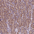 Anti-AP1S3 Antibody