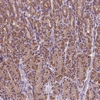 Anti-AP1S3 Antibody