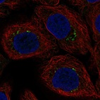 Immunofluorescent staining of human cell line HaCaT shows localization to vesicles.