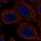 Immunofluorescent staining of human cell line HaCaT shows localization to vesicles.