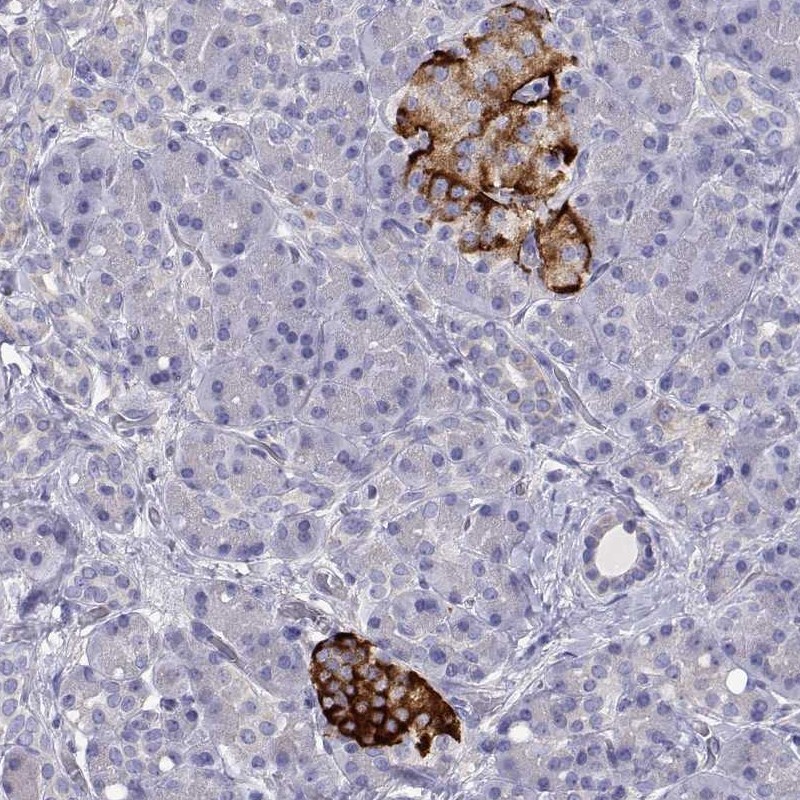 Anti-TMEM211 Antibody
