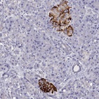 Anti-TMEM211 Antibody