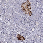 Anti-TMEM211 Antibody
