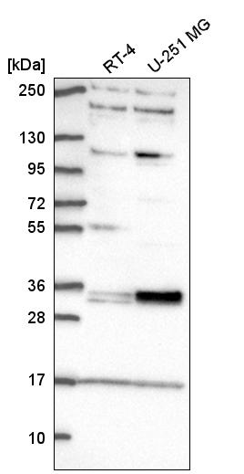 Anti-TSPAN11 Antibody