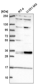 Anti-TSPAN11 Antibody