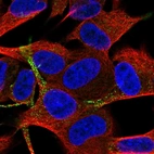 Immunofluorescent staining of human cell line SH-SY5Y shows localization to vesicles.