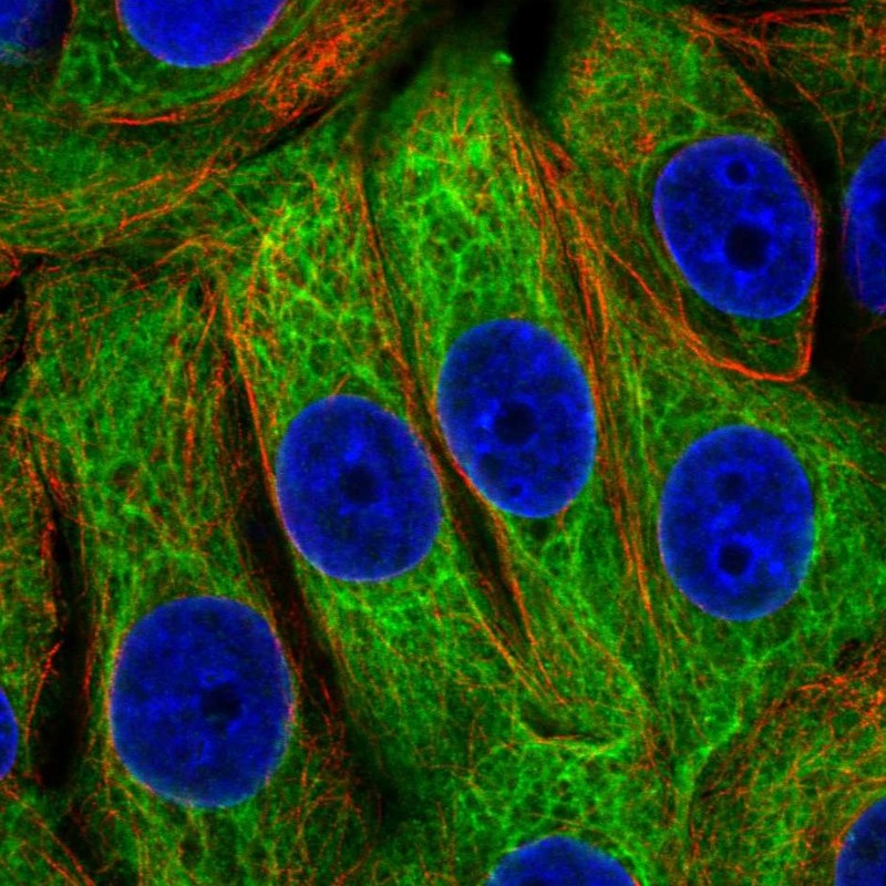 Anti-EPPK1 Antibody