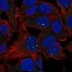 Anti-LACTBL1 Antibody