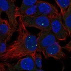Anti-LACTBL1 Antibody