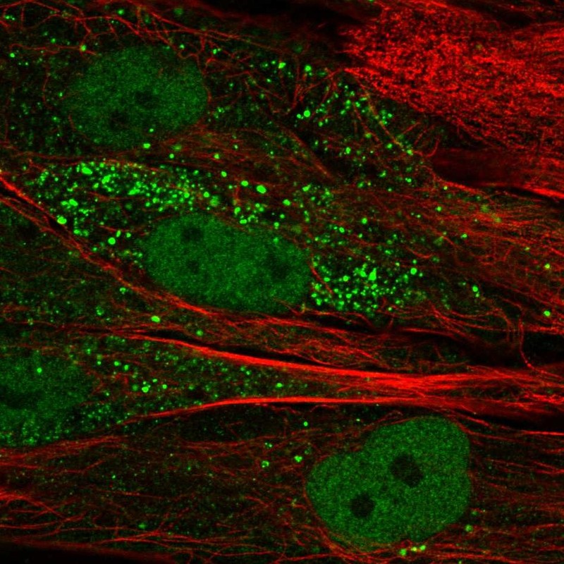 Anti-TTL Antibody