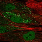 Anti-TTL Antibody