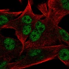 Immunofluorescent staining of human cell line SK-MEL-30 shows localization to nucleoplasm.