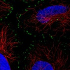Immunofluorescent staining of human cell line HeLa shows localization to focal adhesion sites.