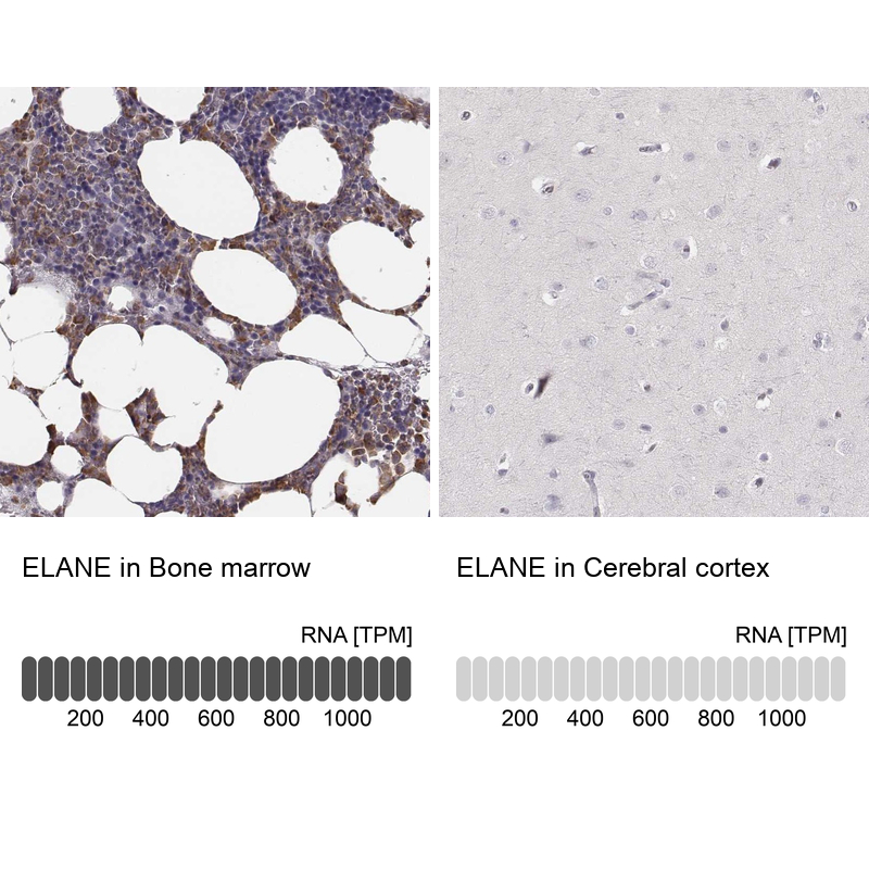 Anti-ELANE Antibody