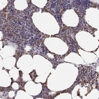 Immunohistochemical staining of human bone marrow shows high expression.