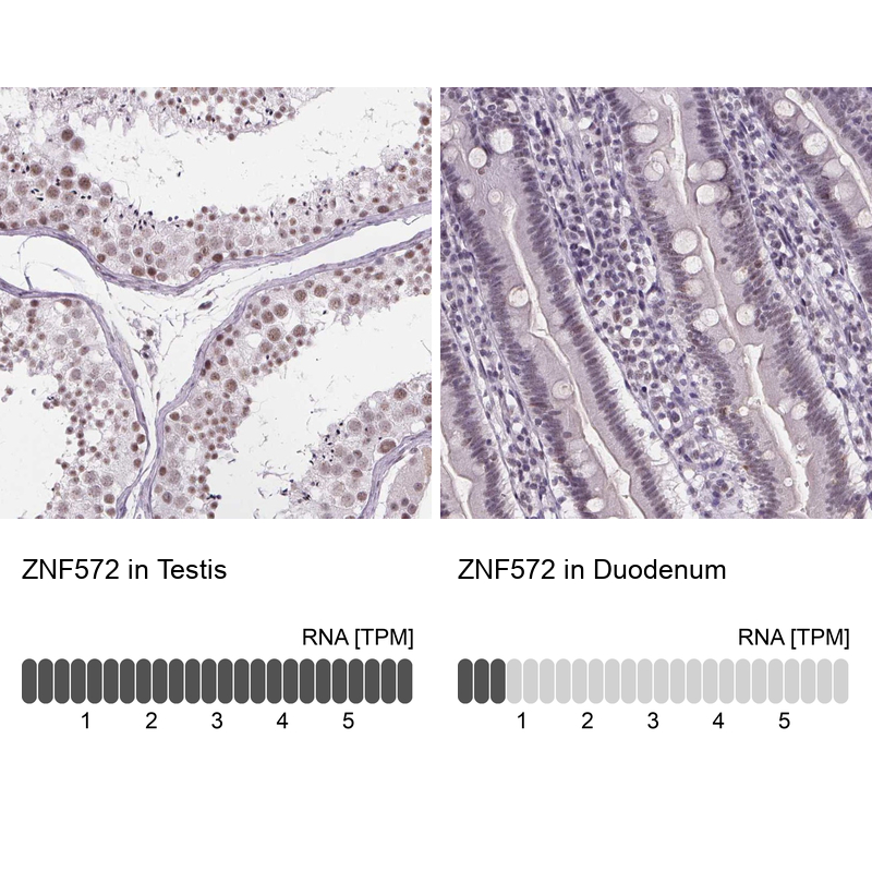 Anti-ZNF572 Antibody